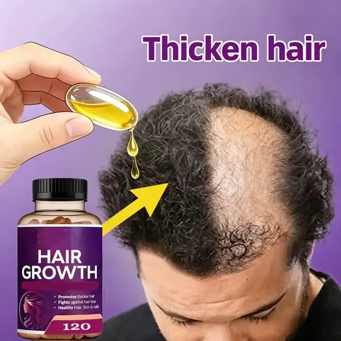 Sérum capillaire pour la repousse des cheveux – Nourrit les follicules et pénètre les racines, traitement naturel de régénération capillaire pour un aspect plus épais et plus volumineux