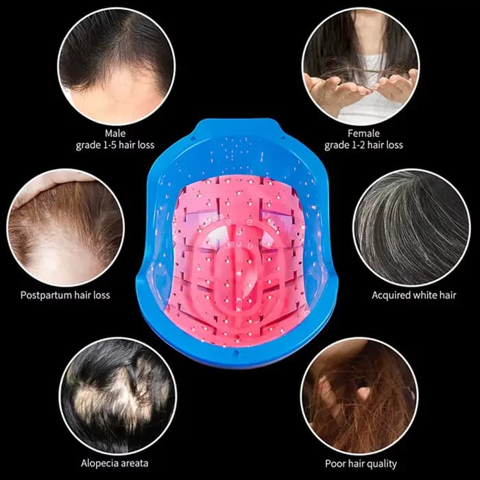Casque de croissance de cheveux au Laser, 272 Diodes, longueur d'onde 678nm, thérapie capillaire Rechargeable par USB pour la repousse des cheveux et le traitement de la perte de cheveux