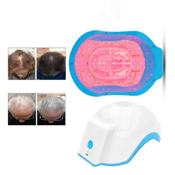 Casque de croissance de cheveux au Laser, 272 Diodes, longueur d'onde 678nm, thérapie capillaire Rec