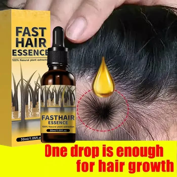 La croissance des cheveux, perte essentielle, traitement de repousse, renforce les cheveux, nourrit le cuir chevelu, léger, Non gras, améliore la Circulation du cuir chevelu